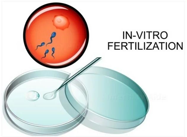 The Future of In Vitro Fertilization